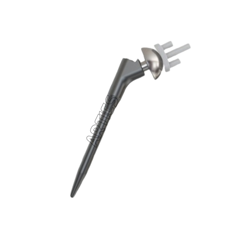 Anatomic Shoulder Replacement